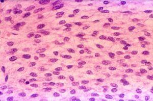 Стовбурові клітини жирової тканини: що це таке?-1