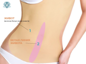 Лазерная эпиляция спины и живота-1