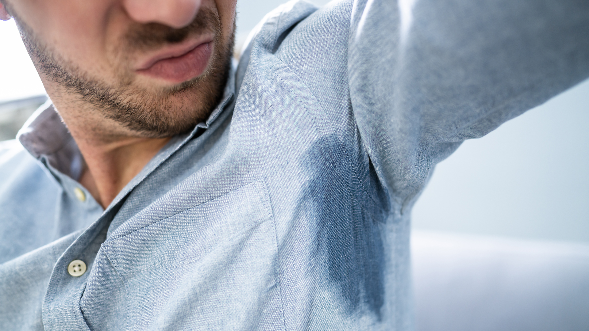 Hyperhidrosis – what is it? Causes and treatment of increased sweating