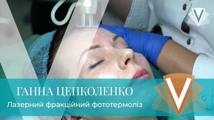 (Русский) Анна Цепколенко: лазерный фракционный фототермолиз