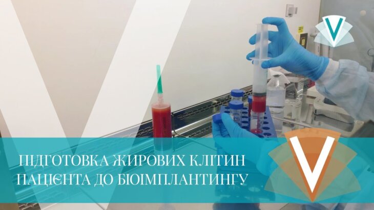 (Русский) Подготовка жировых клеток пациента к биоимплантингу