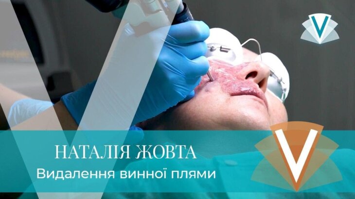 (Русский) Удаление винного пятна