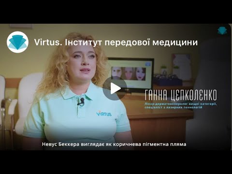 Лазер vs невус беккера  Copy